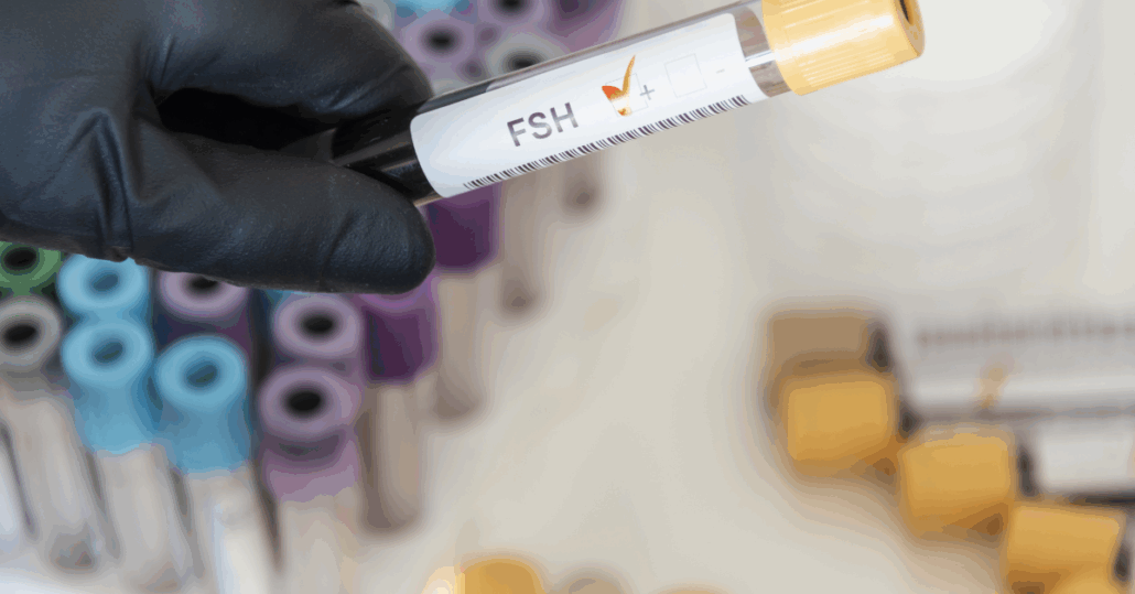 Εξέταση αίματος FSH και σύνδεση με ποιότητα ωαρίων